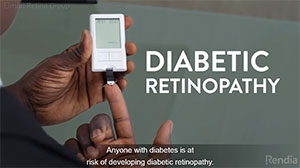 diabetic retinopathy video