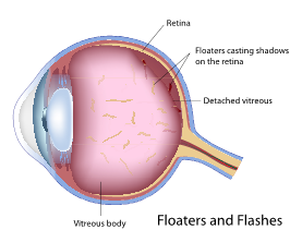 Eye Anatomy – Elman Retina Group