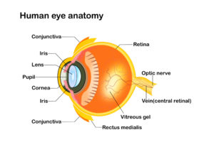 What Is a Vitrectomy