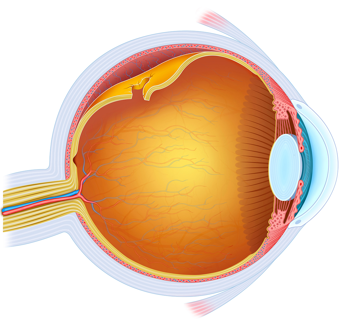 Retinal Detachment Baltimore