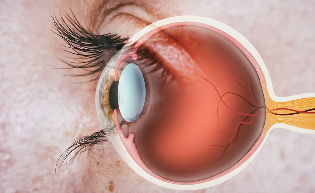 Vitrectomy and retinal repair in Baltimore