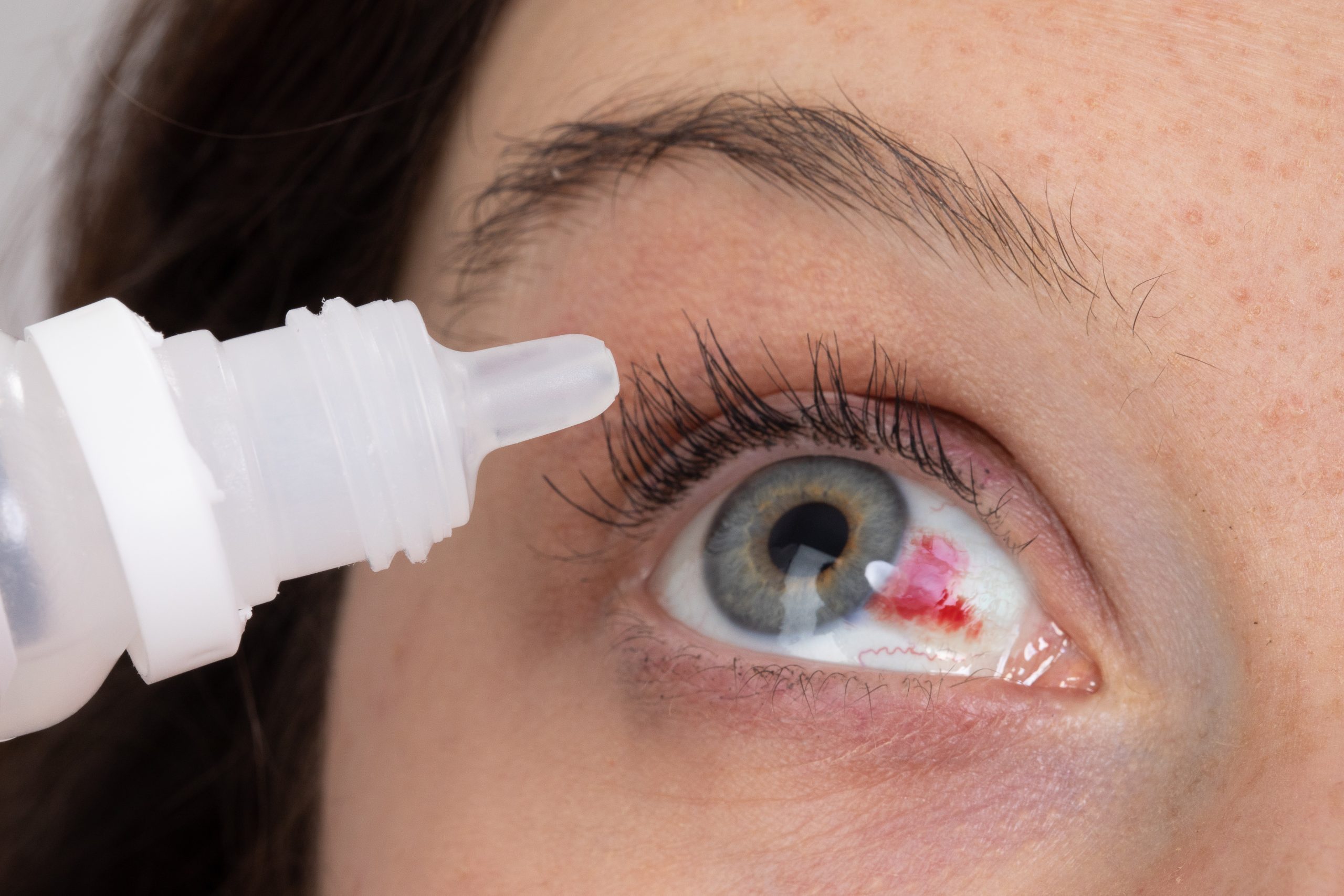 Ocular Trauma Treatment In Rosedale, Pikesville, Catonsville & Glen Burnie, MD
