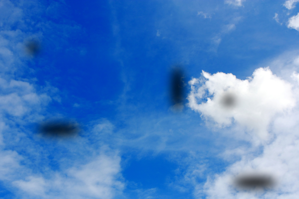 Eye floaters disrupt the field of vision for an unlucky patient.